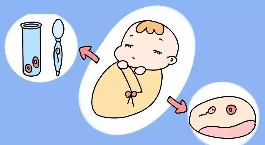 在成都做试管婴儿要注意什么？ 